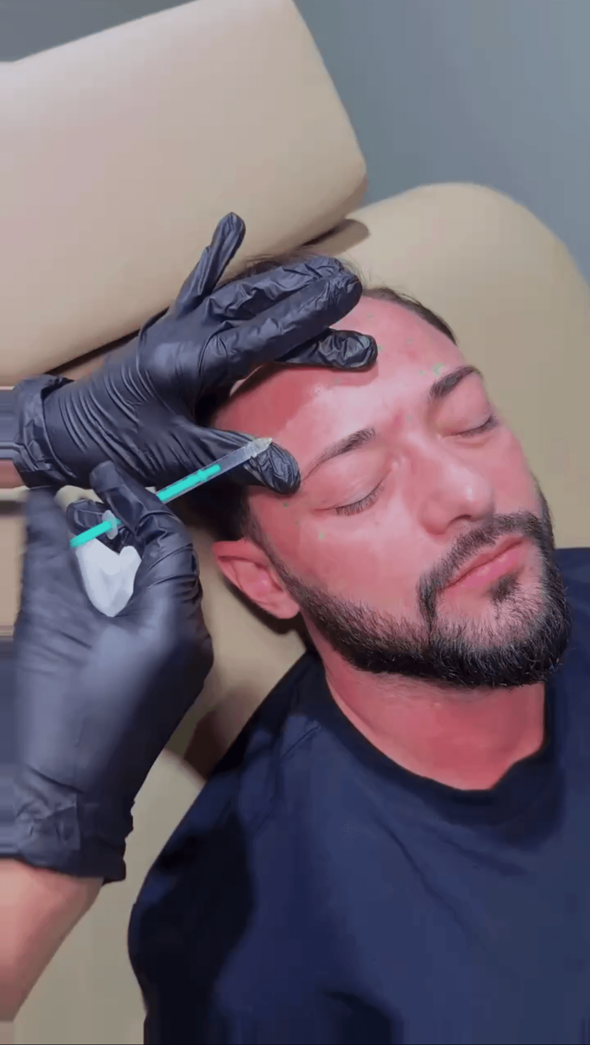 When Botox Goes Wrong on Men—and How We Avoid It at TMRW