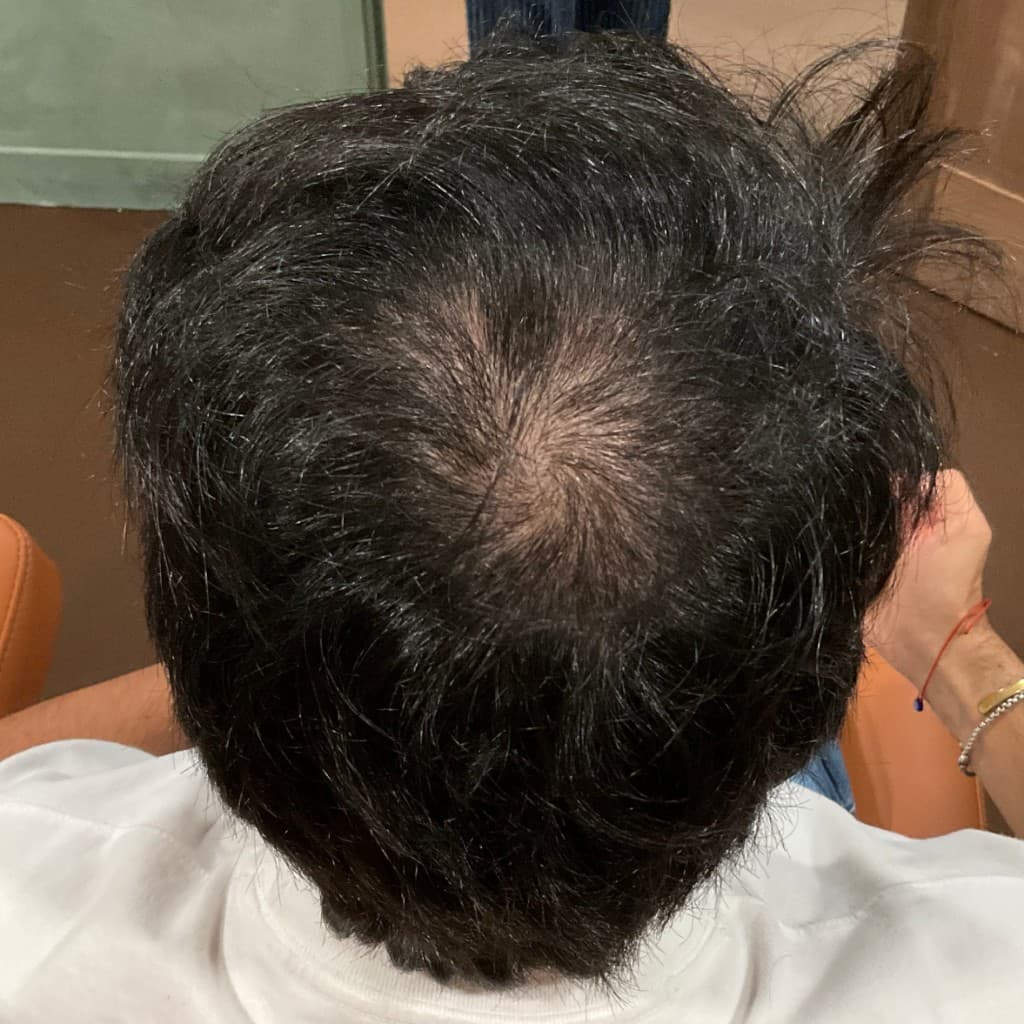 After