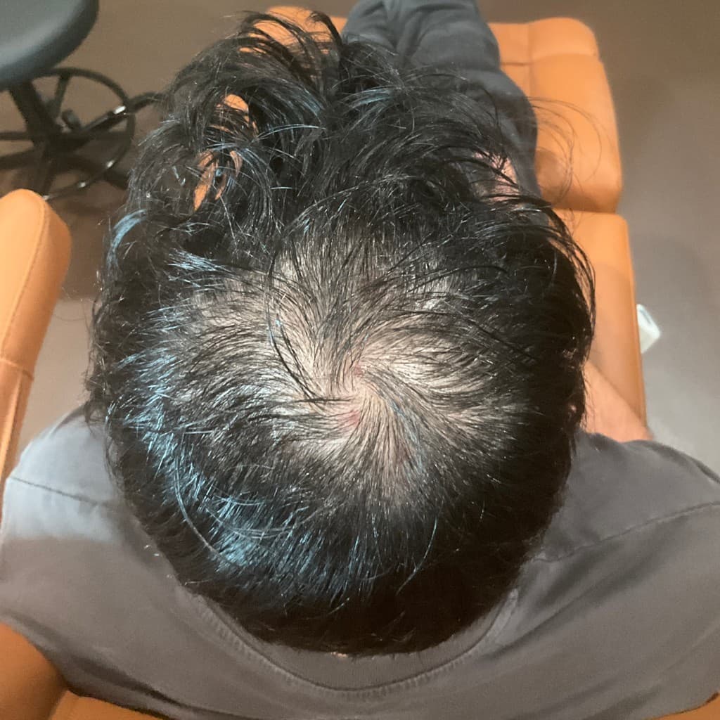 Before