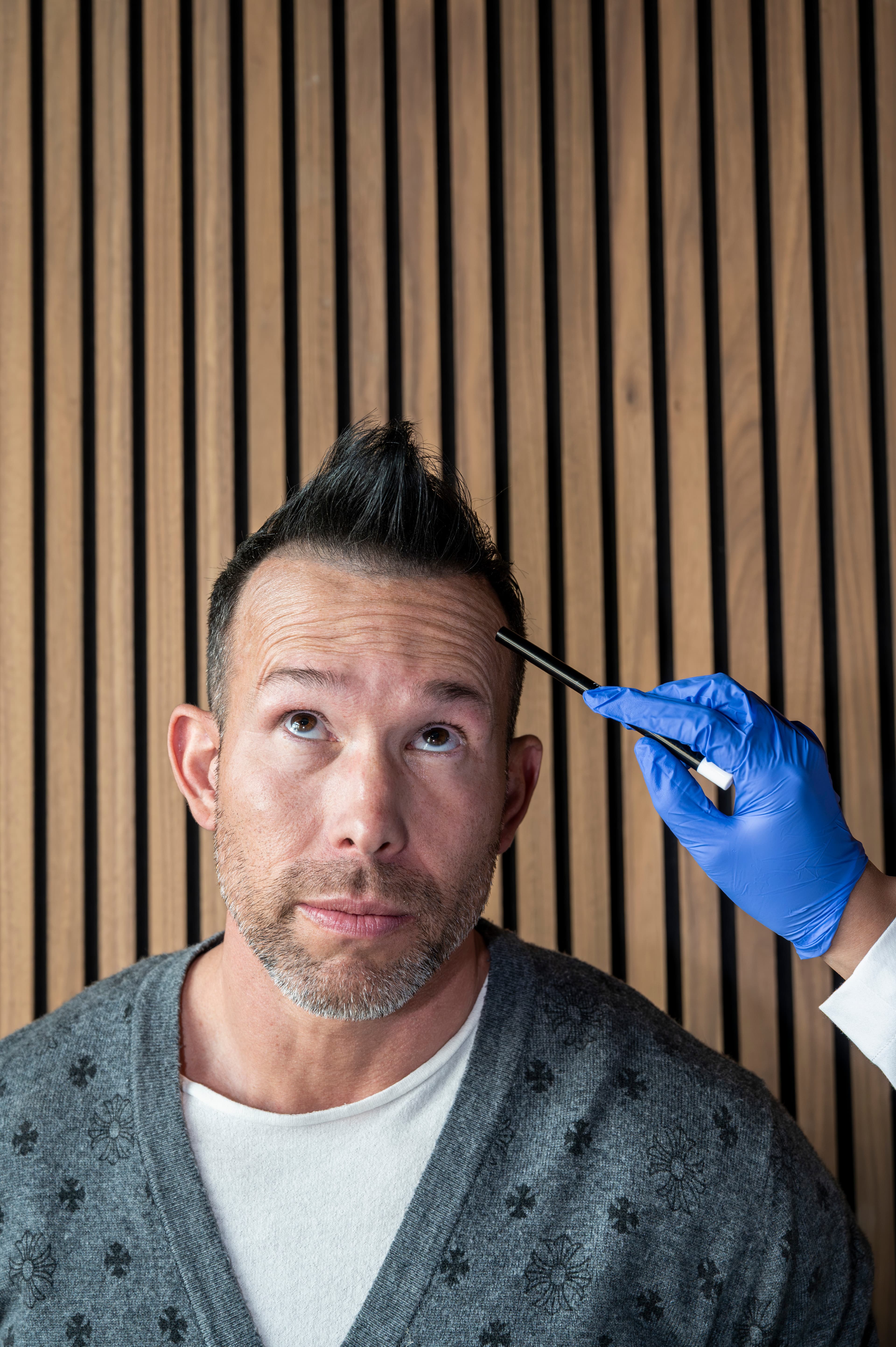 Botox Timeline for Men: Day 1 to Day 14