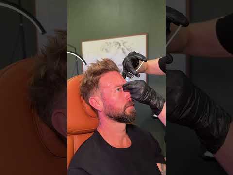 Reduce Wrinkles testimonial