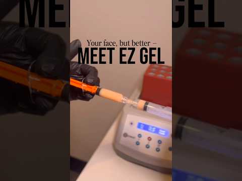 Filler for Under Eyes testimonial